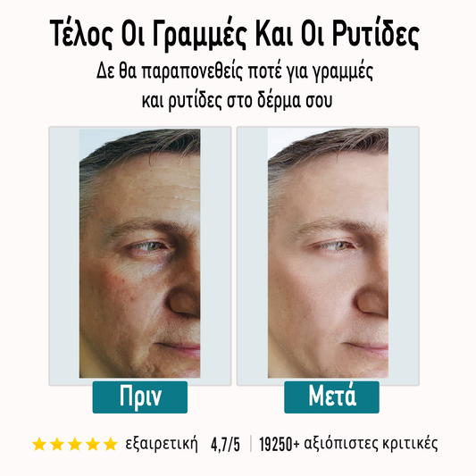 FORGALIN™  No1 ανδική κρέμα κατά των ρυτίδων και της γήρανσης!