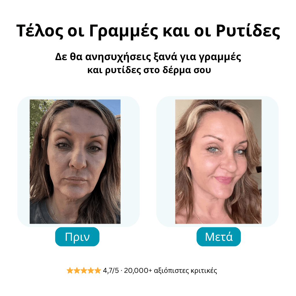 FORGALIN™ Νο1 γυναικεία κρέμα κατά των ρυτίδων και της γήρανσης!