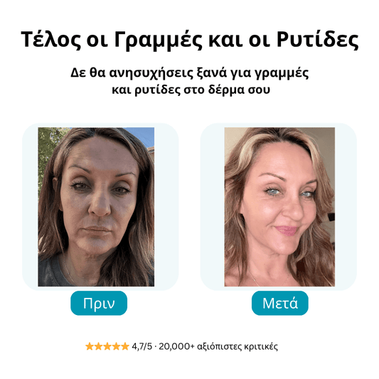 FORGALIN™ Νο1 γυναικεία κρέμα κατά των ρυτίδων και της γήρανσης!